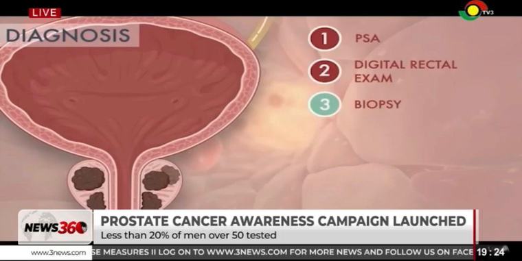 Prostate Cancer: The earlier you know, the more options you have