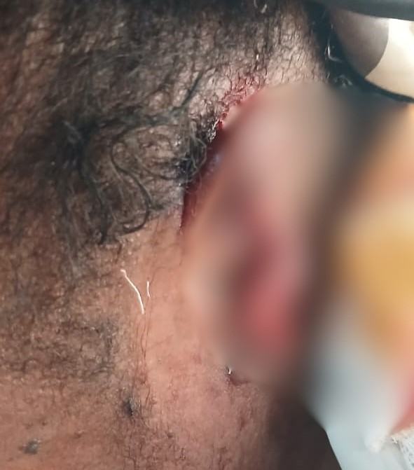 Police arrest landlord’s wife for allegedly biting tenant’s ear during a fight