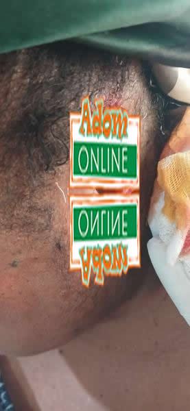 Police arrest landlord’s wife for allegedly biting tenant’s ear in fight over child discipline